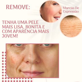 NaturaVitta® - Adesivos Antirrugas e Expressão Facial Reutilizável  - 18 Peças